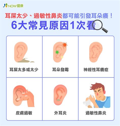 耳朵癢代表|耳朵癢卻沒有耳屎，是耳朵發黴？專家曝6大原因、4緩解法 